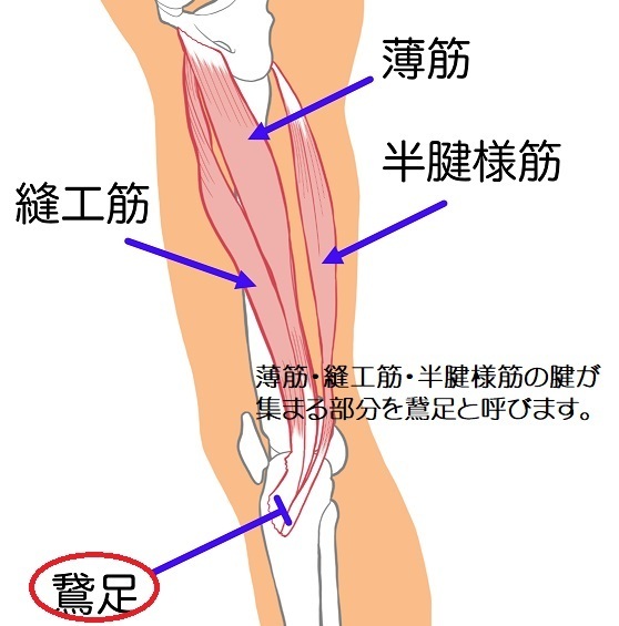膝の痛み鵞足炎