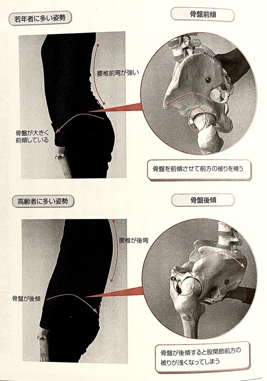 よくわかる股関節・骨盤の動きとしくみ 「動き」と「痛み」のメカニズムを図解で学… 図解入門 よくわかる 股関節・骨盤の動きとしくみ - 秀和システム新社